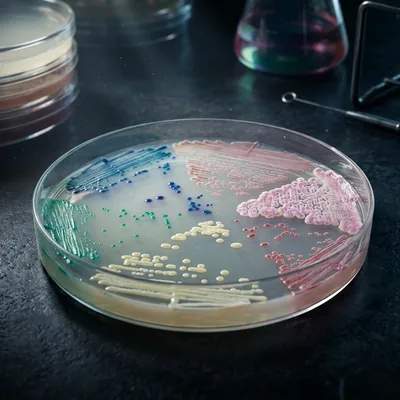 Medios Cromogénicos